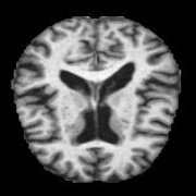 VeryMildDemented (123).jpg